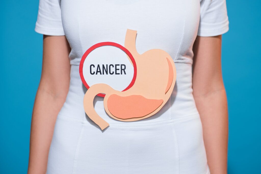 cropped shot of woman with paper crafted stomach and cancer lettering on blue background